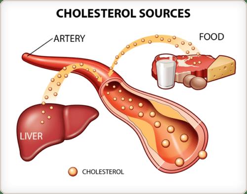 punca kolesterol